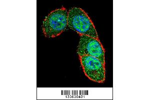 Confocal immunofluorescent analysis of SMAD3 Antibody with Hela cell followed by Alexa Fluor 488-conjugated goat anti-rabbit lgG (green). (SMAD3 antibody  (AA 127-156))