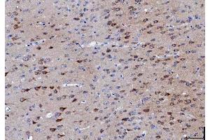 IHC analysis of LNPEP using anti-LNPEP antibody (ABIN7600279). (LNPEP antibody  (AA 17-994))