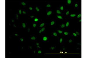 Immunofluorescence of monoclonal antibody to MEIS2 on HeLa cell. (MEIS2 antibody  (AA 1-381))