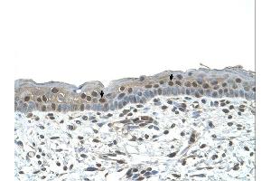 Immunohistochemistry (IHC) image for anti-Nuclear Receptor Subfamily 2, Group C, Member 2 (NR2C2) (C-Term) antibody (ABIN2783187)