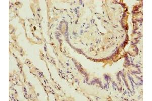 Immunohistochemistry (IHC) image for anti-Leucine Rich Repeat Containing 8 Family, Member E (LRRC8E) (AA 353-630) antibody (ABIN7175622)