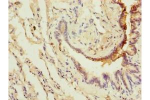 Immunohistochemistry of paraffin-embedded human lung tissue using ABIN7175622 at dilution of 1:100 (LRRC8E antibody  (AA 353-630))