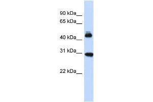Host:  Rabbit  Target Name:  CBX4  Sample Type:  Fetal Brain lysates  Antibody Dilution:  1. (CBX4 antibody  (Middle Region))