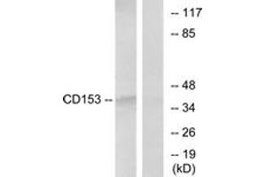 Western Blotting (WB) image for anti-Tumor Necrosis Factor (Ligand) Superfamily, Member 8 (TNFSF8) (AA 71-120) antibody (ABIN1533700)