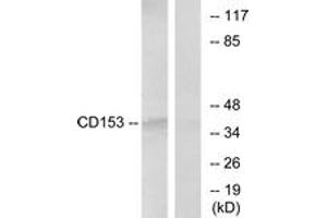 Western blot analysis of extracts from RAW264. (TNFSF8 antibody  (AA 71-120))