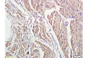 Formalin-fixed and paraffin embedded rat heart labeled with Anti-phospho-ROCK1(Thr455/Ser456) Polyclonal Antibody, Unconjugated (ABIN707771) at 1:200 followed by conjugation to the secondary antibody and DAB staining. (ROCK1 antibody  (pSer456, pThr455))