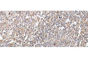 Immunohistochemistry of paraffin-embedded Human tonsil tissue using GNAI2 Polyclonal Antibody at dilution of 1:25(x200)