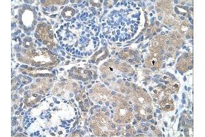 SARDH antibody was used for immunohistochemistry at a concentration of 4-8 ug/ml. (SARDH antibody  (Middle Region))