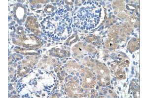 SARDH antibody was used for immunohistochemistry at a concentration of 4-8 ug/ml. (SARDH antibody  (Middle Region))