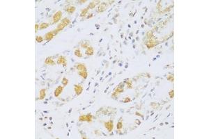 Immunohistochemistry of paraffin-embedded human stomach using FDXR antibody (ABIN5972045) at dilution of 1/100 (40x lens). (Ferredoxin Reductase antibody)
