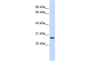 LSM12 antibody used at 1 ug/ml to detect target protein.