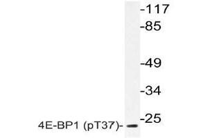 Western blot (WB) analyzes of p-4E-BP1 (pThr37) antibody in extracts from MDA-MB-435 EGF cells. (eIF4EBP1 antibody  (pThr37))