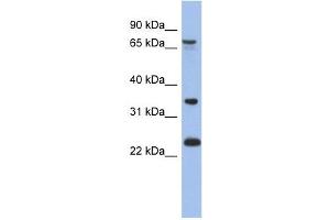 TBC1D25 antibody used at 1 ug/ml to detect target protein. (TBC1D25 antibody  (N-Term))