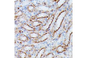 Immunohistochemistry of paraffin-embedded rat kidney using IDH3A antibody (ABIN7268029) at dilution of 1:100 (40x lens). (IDH3A antibody  (AA 28-366))