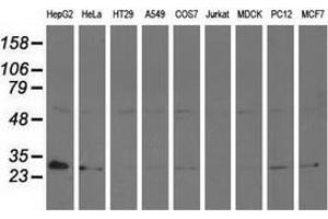 Western blot analysis of extracts (35 µg) from 9 different cell lines by using anti-AK3 monoclonal antibody. (Adenylate Kinase 3 antibody)