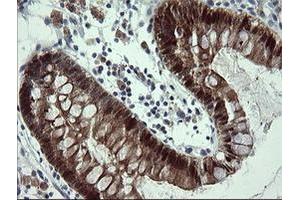 Image no. 5 for anti-Cytidine Monophosphate (UMP-CMP) Kinase 1, Cytosolic (CMPK1) antibody (ABIN1497544) (Cytidine Monophosphate (UMP-CMP) Kinase 1, Cytosolic (CMPK1) antibody)