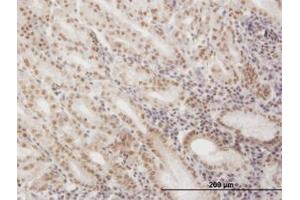 Image no. 1 for anti-Small Nuclear RNA Activating Complex, Polypeptide 4, 190kDa (SNAPC4) (AA 53-163) antibody (ABIN598934) (SNAPC4 antibody  (AA 53-163))
