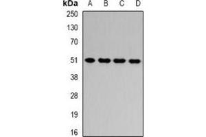 Western blot analysis of HADHB expression in HepG2 (A), Jurkat (B), mouse liver (C), rat liver (D) whole cell lysates. (HADHB antibody)