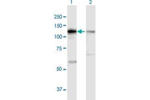 DIS3 Antikörper  (AA 1-958)