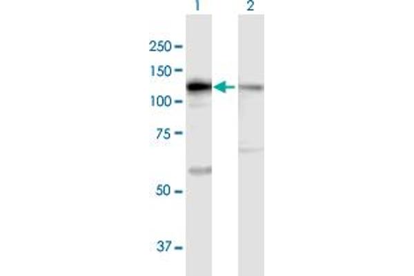 DIS3 Antikörper  (AA 1-958)