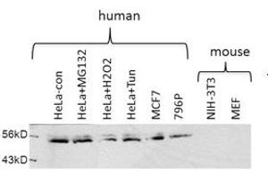 USP30 antibody - middle region  validated by WB using Hela cell lysate (Usp30 antibody  (Middle Region))