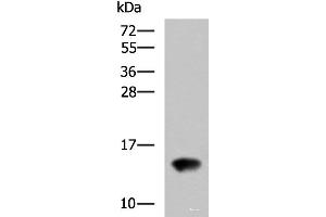 Western blot analysis of Rat kidney tissue lysate using FAM19A4 Polyclonal Antibody at dilution of 1:650 (FAM19A4 antibody)