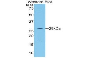 Western Blotting (WB) image for anti-Lymphocyte-Activation Gene 3 (LAG3) (AA 274-504) antibody (ABIN1859591) (LAG3 antibody  (AA 274-504))