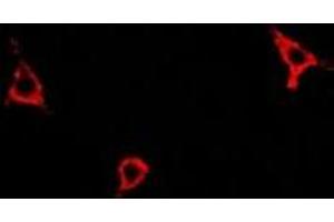 Immunofluorescent analysis of Asparagine Synthetase staining in A549 cells.
