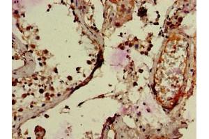 Immunohistochemistry of paraffin-embedded human testis tissue using ABIN7151134 at dilution of 1:100 (RNF126 antibody  (AA 39-225))