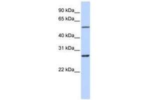 Image no. 1 for anti-Ring Finger Protein 217 (RNF217) (C-Term) antibody (ABIN6740824) (RNF217 antibody  (C-Term))