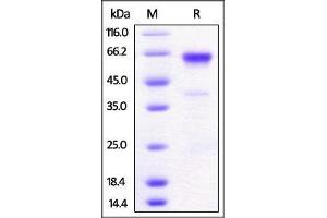 SDS-PAGE (SDS) image for Tumor Necrosis Factor Receptor Superfamily, Member 9 (TNFRSF9) (AA 24-211) protein (Fc Tag) (ABIN2870707)