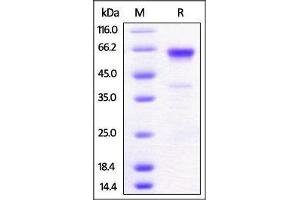 Mouse 4-1BB, Fc Tag on SDS-PAGE under reducing (R) condition. (CD137 Protein (AA 24-211) (Fc Tag))