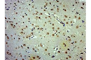 Paraformaldehyde-fixed, paraffin embedded Rat brain; Antigen retrieval by boiling in sodium citrate buffer (pH6. (APC1 antibody  (pSer377))