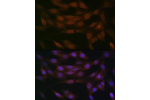 Immunofluorescence (IF) image for anti-Emerin (EMD) antibody (ABIN7266933)