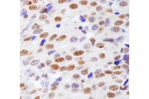 Immunohistochemistry (IHC) image for anti-Histone H4 (HISTH4) (AA 1-50) antibody (ABIN7453609)