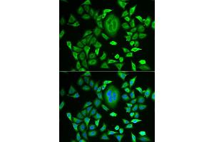Immunofluorescence analysis of MCF-7 cell using RBP3 antibody.