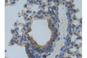 Detection of MYO1A in Mouse Lung Tissue using Polyclonal Antibody to Myosin IA (MYO1A) (Myosin IA antibody  (AA 783-1043))