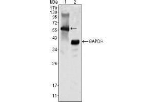 Western blot analysis using MATK mouse mAb against K562 cell lysate (1).