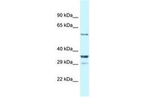CBLL1 Antikörper  (AA 413-462)