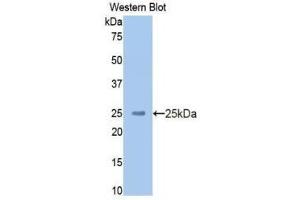 Western Blotting (WB) image for anti-Kininogen (High Molecular Weight) (AA 225-407) antibody (ABIN1859236) (Kininogen (HMW) antibody  (AA 225-407))