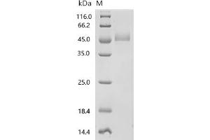 Fibronectin 1 (FN1) (AA 25-404) protein (His tag)