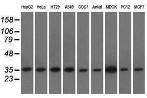 Image no. 1 for anti-Eukaryotic Translation Initiation Factor 2 Subunit 1 (EIF2S1) antibody (ABIN1497970) (EIF2S1 antibody)