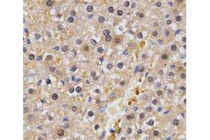 Immunohistochemistry of paraffin-embedded Rat liver using HSF2 Polyclonal Antibody at dilution of 1:200 (40x lens).