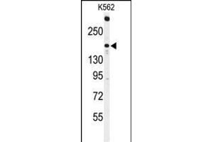 TNK2 antibody  (N-Term)