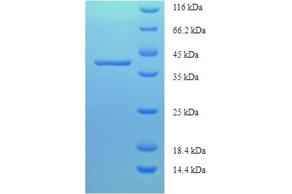 LARP1B Protein (AA 1-201, full length) (His-SUMO Tag)