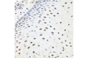 Immunohistochemistry of paraffin-embedded human esophagus using EXO1 antibody (ABIN6129824, ABIN6140356, ABIN6140357 and ABIN6219087) at dilution of 1:100 (40x lens).