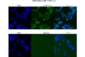 Sample Type : HCT116  Primary Antibody Dilution: 4 ug/ml  Secondary Antibody : Anti-rabbit Alexa 546  Secondary Antibody Dilution: 2 ug/ml  Gene Name : NSMCE4A