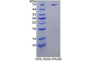 SDS-PAGE (SDS) image for Killer Cell Immunoglobulin-Like Receptor, Two Domains, Long Cytoplasmic Tail, 1 (KIR2DL1) (AA 22-348) protein (His tag,GST tag) (ABIN1879130) (KIR2DL1 Protein (AA 22-348) (His tag,GST tag))