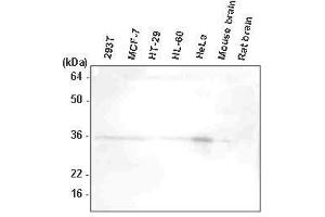 The extracts of 293T, MCF7, HT-29, HL-60, HeLa, mouse brain, and rat brain were resolved by SDS-PAGE, transferred to PVDF membrane and probed with anti-human HtrA2/Omi antibody (1:1,000). (HTRA2 antibody  (AA 134-458))