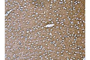 IHC analysis of SYP using anti-SYP antibody (ABIN7603120).